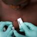 DGS confirma 14 casos de infeção humana por vírus Monkeypox em Portugal