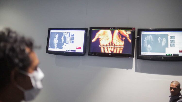 País: Sobe para 23 o número de casos confirmados de Monkeypox