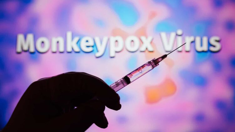 Já são 191 casos confirmados de Monkeypox em Portugal