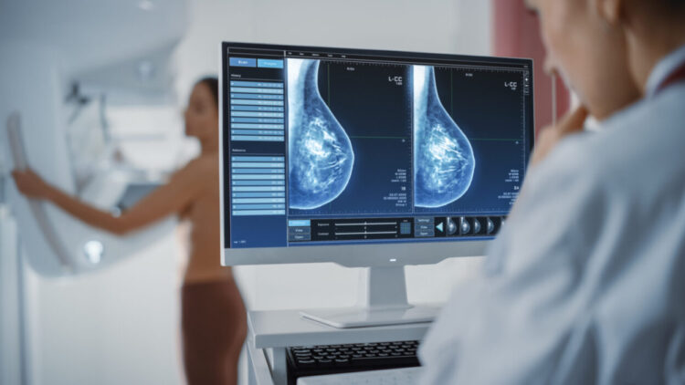 Prevenção do cancro: mulheres que fazem 45 anos em 2025 vão ser convocadas para mamografia