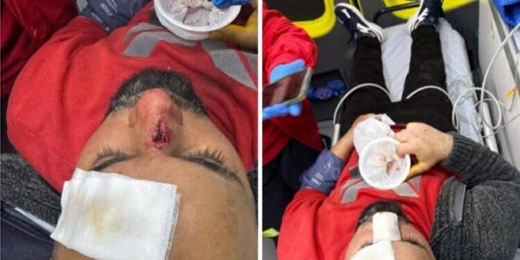 Homem agredido em Oliveira do Hospital