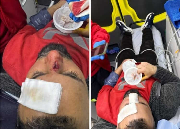 Homem agredido em Oliveira do Hospital